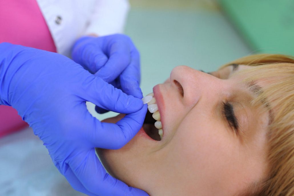 cosmetic-dentistry-claims-how-much-compensation-can-i-claim-claims